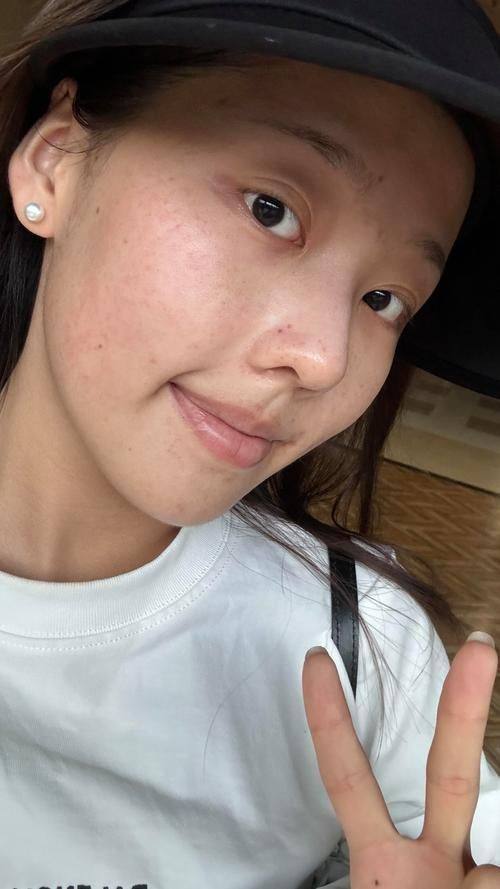 南充嘉陵江整形美容机构口碑评价：