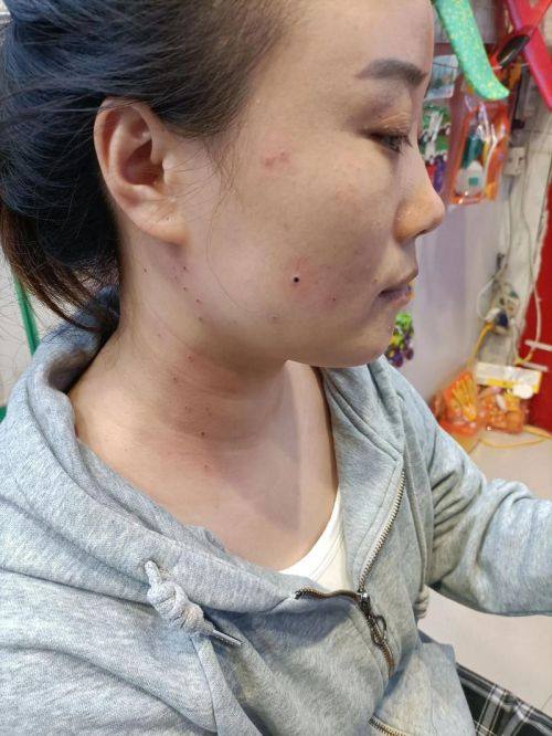 南通爱婍艺整形医院擅长项目: