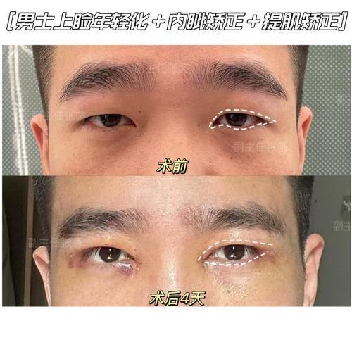 眉山壹心壹意整形医院怎么样？