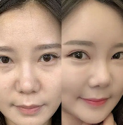 四、不可忽视的体重反弹风险