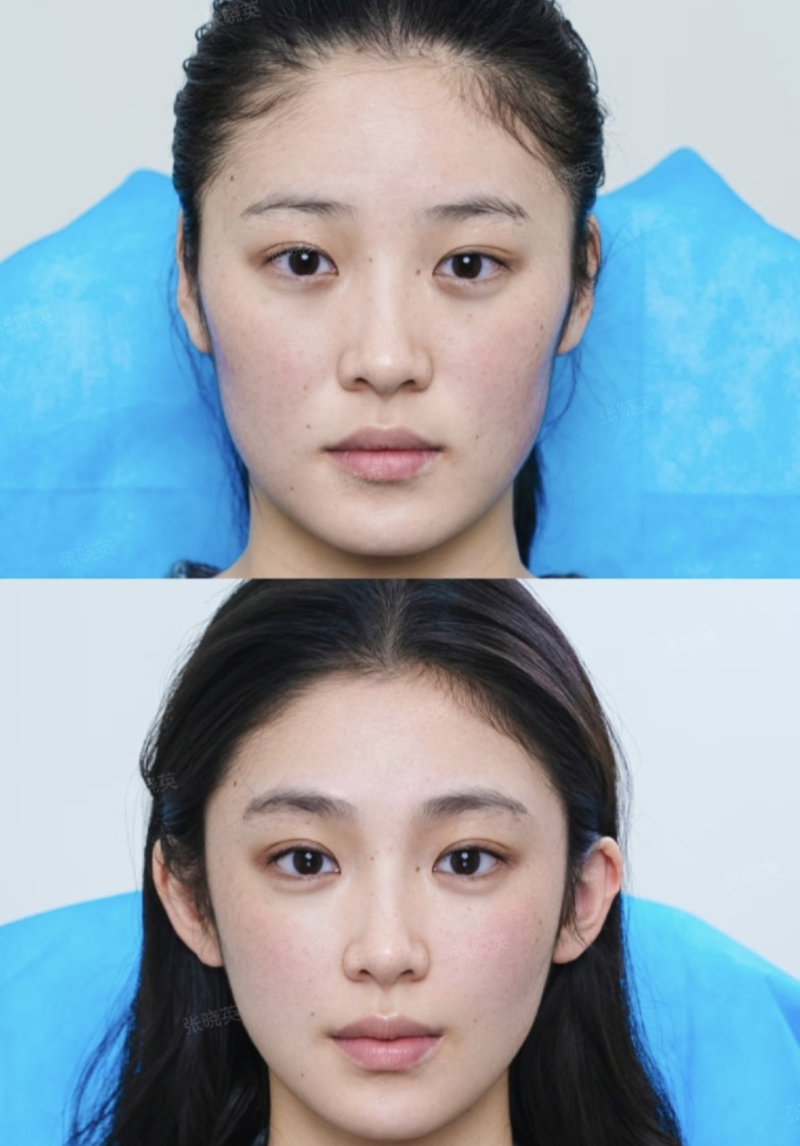 四、关于华美祛眼袋,你关心的价格问题