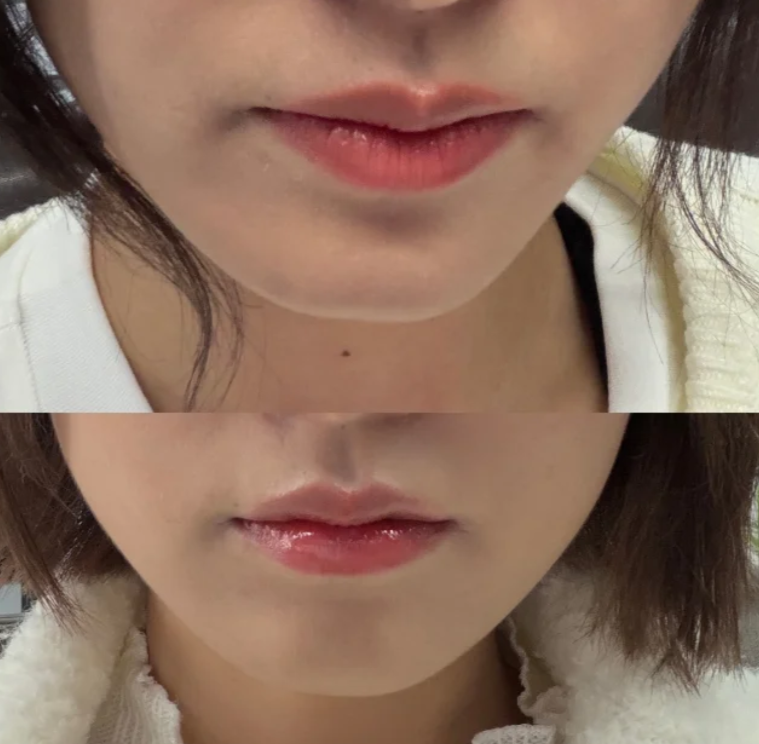 成都高新恩美医疗美容诊所擅长项目: