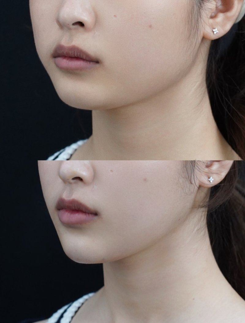 眉山壹心壹意整形医院口碑评价：