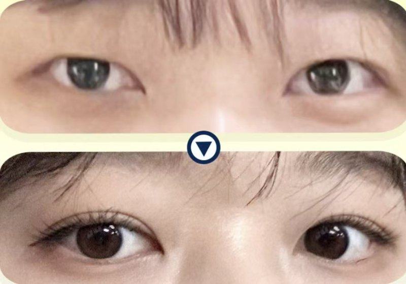 乌鲁木齐整形医院医生名单及擅长领域：