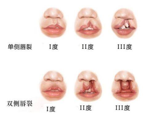 北京华美宝丽门诊部医生名单及擅长领域：