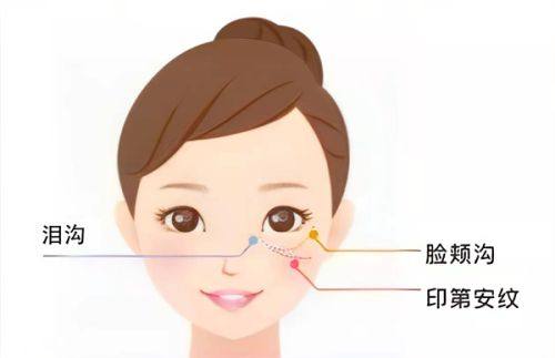 二、自体耳软骨隆鼻的修复节奏