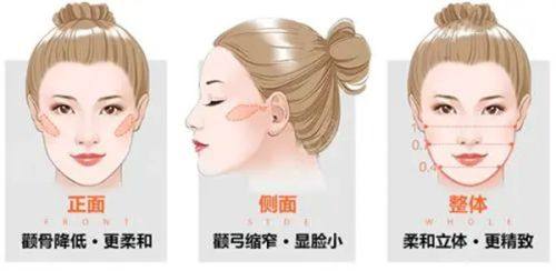 五、隆鼻完全自然与至佳成效的时间节点