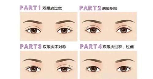 上海千美整形医院擅长项目：