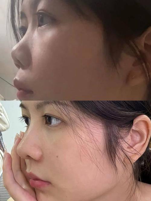 上海千美整形医院医生名单及擅长领域：