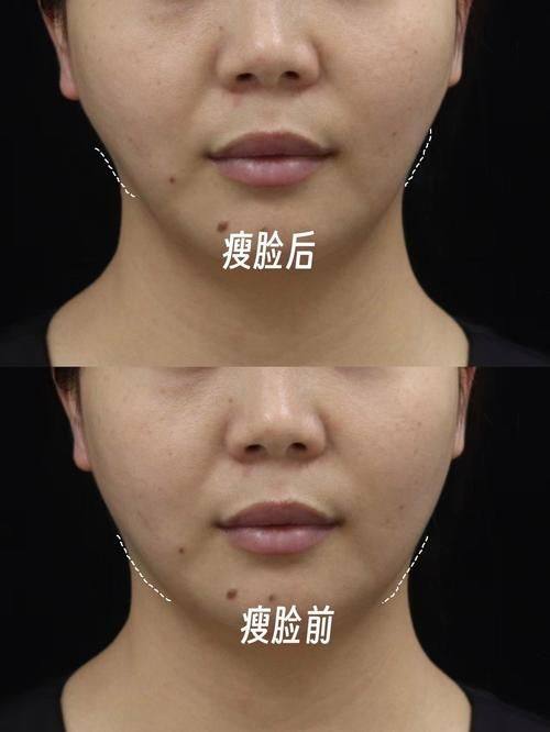 特秀恩碧三成店预约挂号方式：