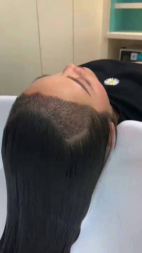 青岛韩植信毛发研究所预约挂号方式: