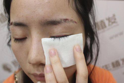 青岛韩植信毛发研究所怎么样?