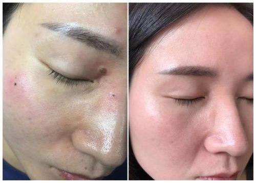 北京澳玛医疗整形美容擅长项目: