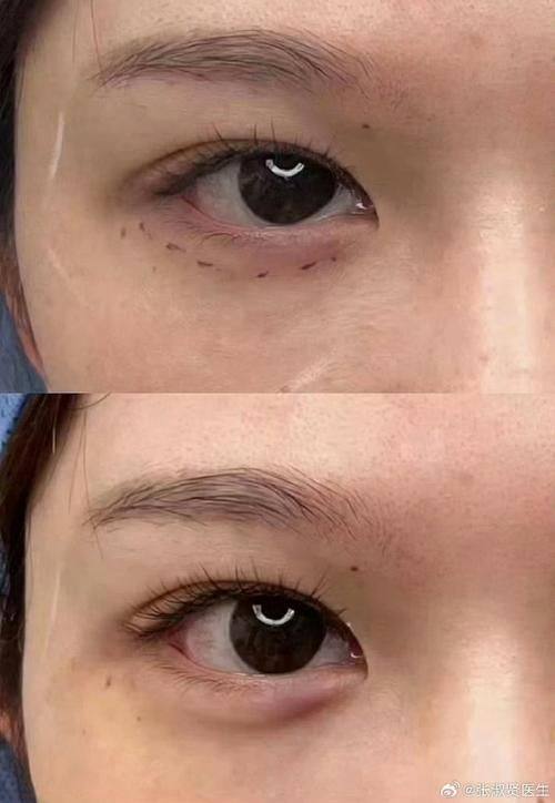 兴义新颜医疗美容门诊部口碑评价：