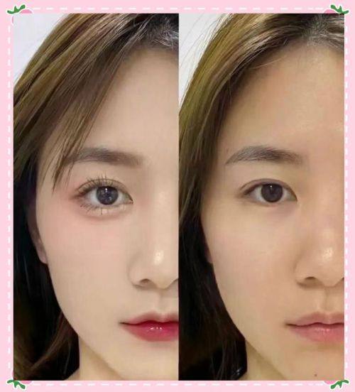 兴义新颜医疗美容门诊部擅长项目：