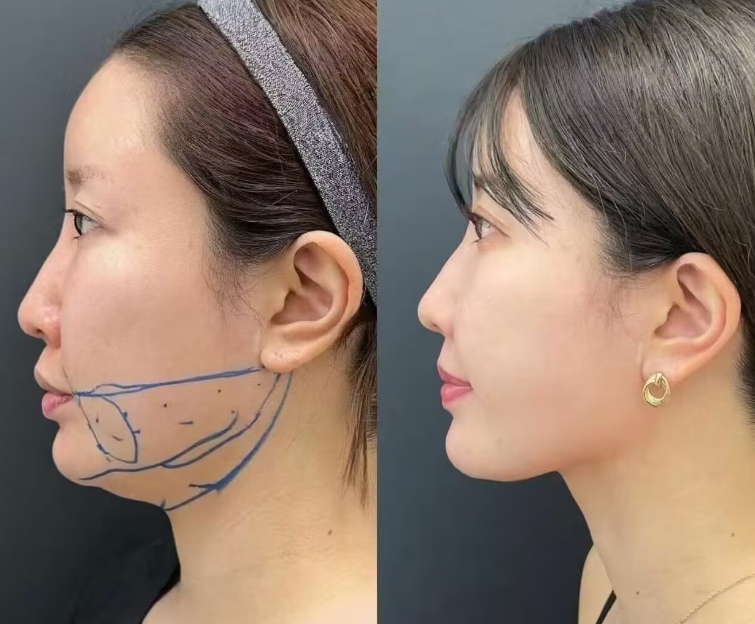 启东蝶美莎医疗美容门诊部预约挂号方式：