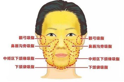 二、分阶段精细干预:覆盖术前到术后6个月的全周期