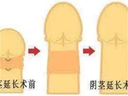 四、眼袋与黑眼圈的本质区别