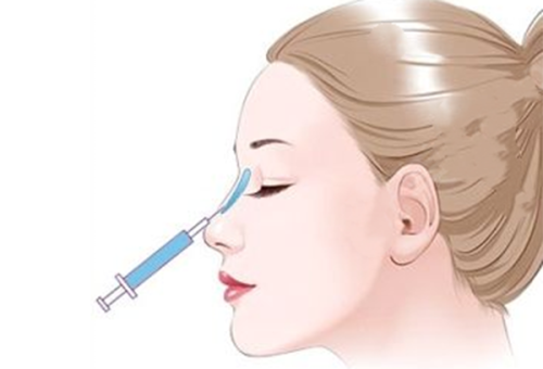 四、第二次做隆鼻手术风险有多大