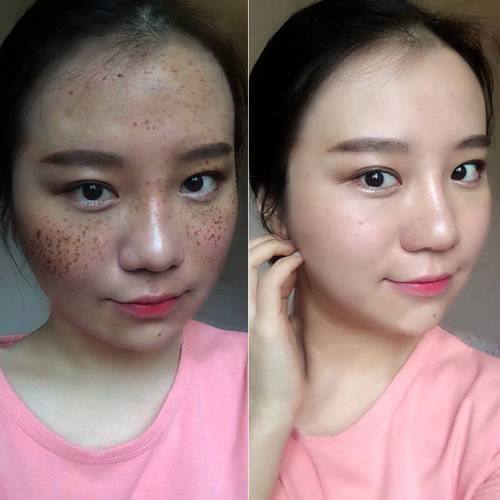 温州铂妍医疗美容怎么样?