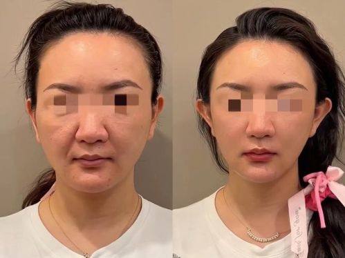 信阳修行美林医疗美容整形口碑评价