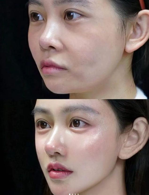 烟台悦莱整形医院口碑评价