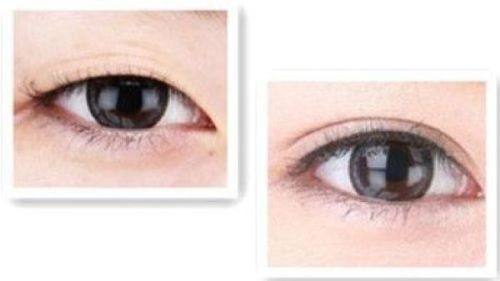 太原美客博仕医疗美容价格表: