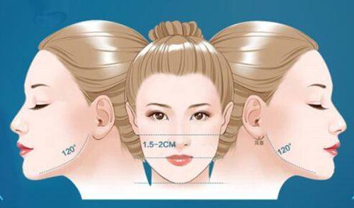四、术后2个月仍有微肿：不适合种睫毛