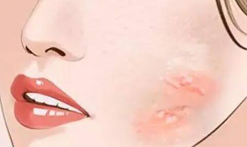 三、术后2周-1个月：新头发悄悄“冒头”的初期阶段