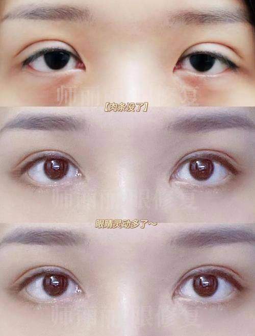 西安刘美容医疗美容诊所擅长项目：