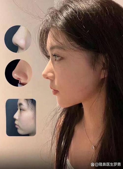 监利白衣天使医疗美容诊所价格表: