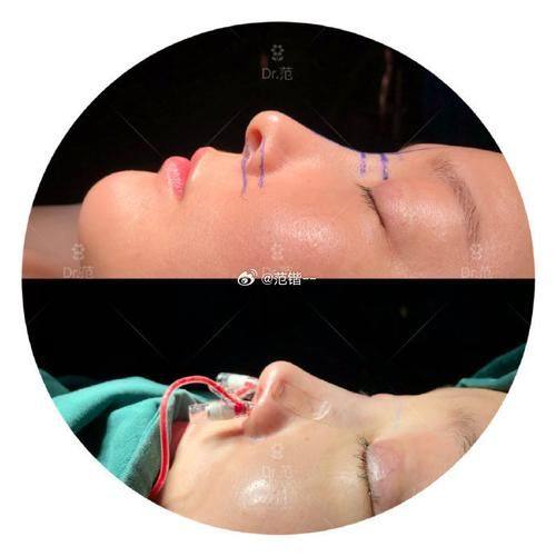 监利白衣天使医疗美容诊所地址电话及营业时间: