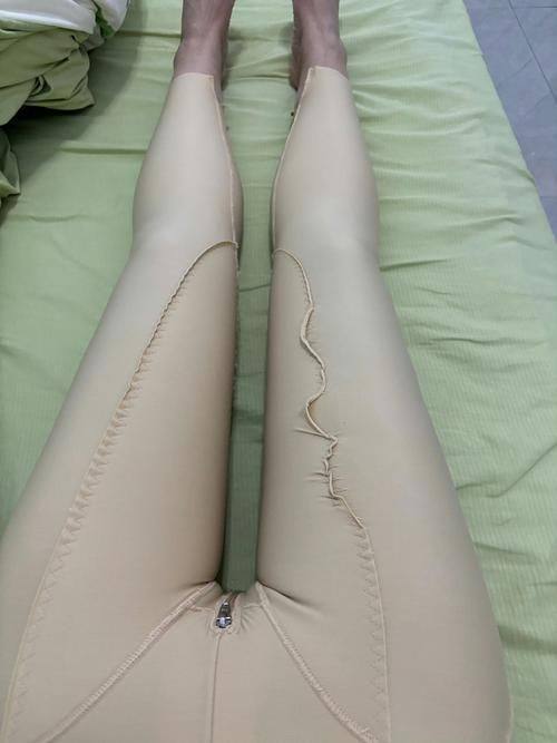 佛山微雨医疗美容门诊部擅长项目：