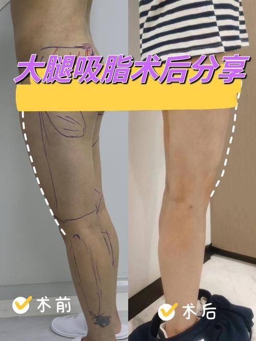 佛山微雨医疗美容门诊部医生名单及擅长领域：