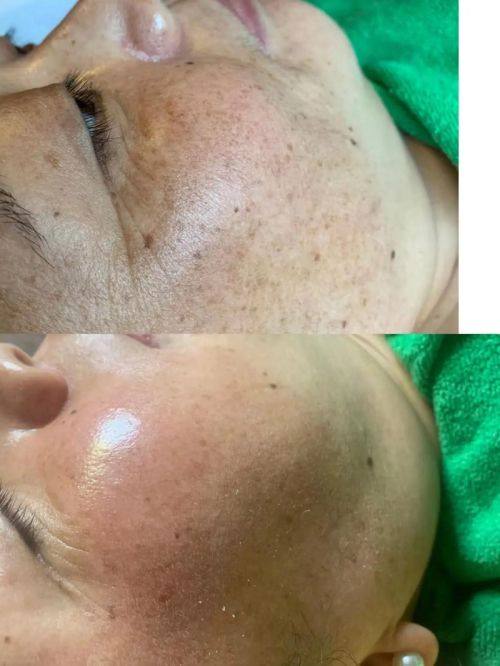 临沂琪美医疗美容门诊部医生名单及擅长领域：