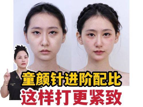 达州紫蝶医疗美容诊所口碑评价