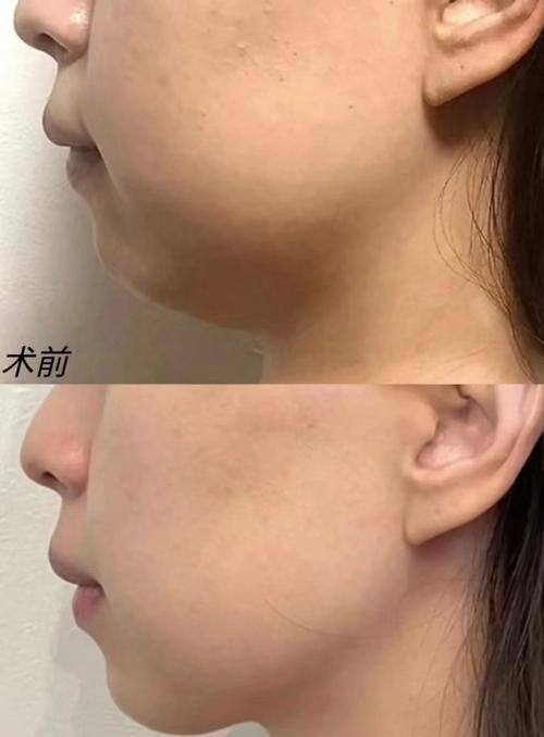 宝鸡高新开发区爱容妍医疗美容门诊部地址电话及营业时间