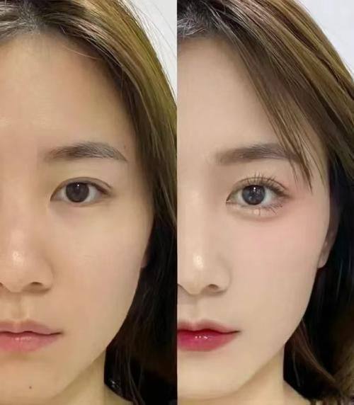 监利白衣天使医疗美容诊所怎么样?