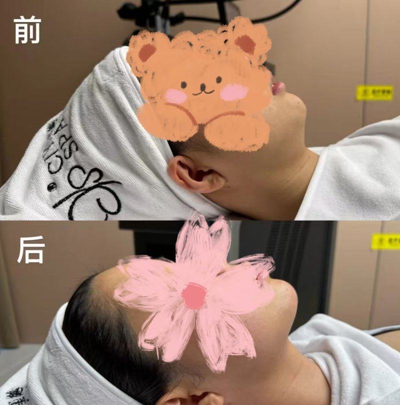 上饶市人民医院整形美容部价格表