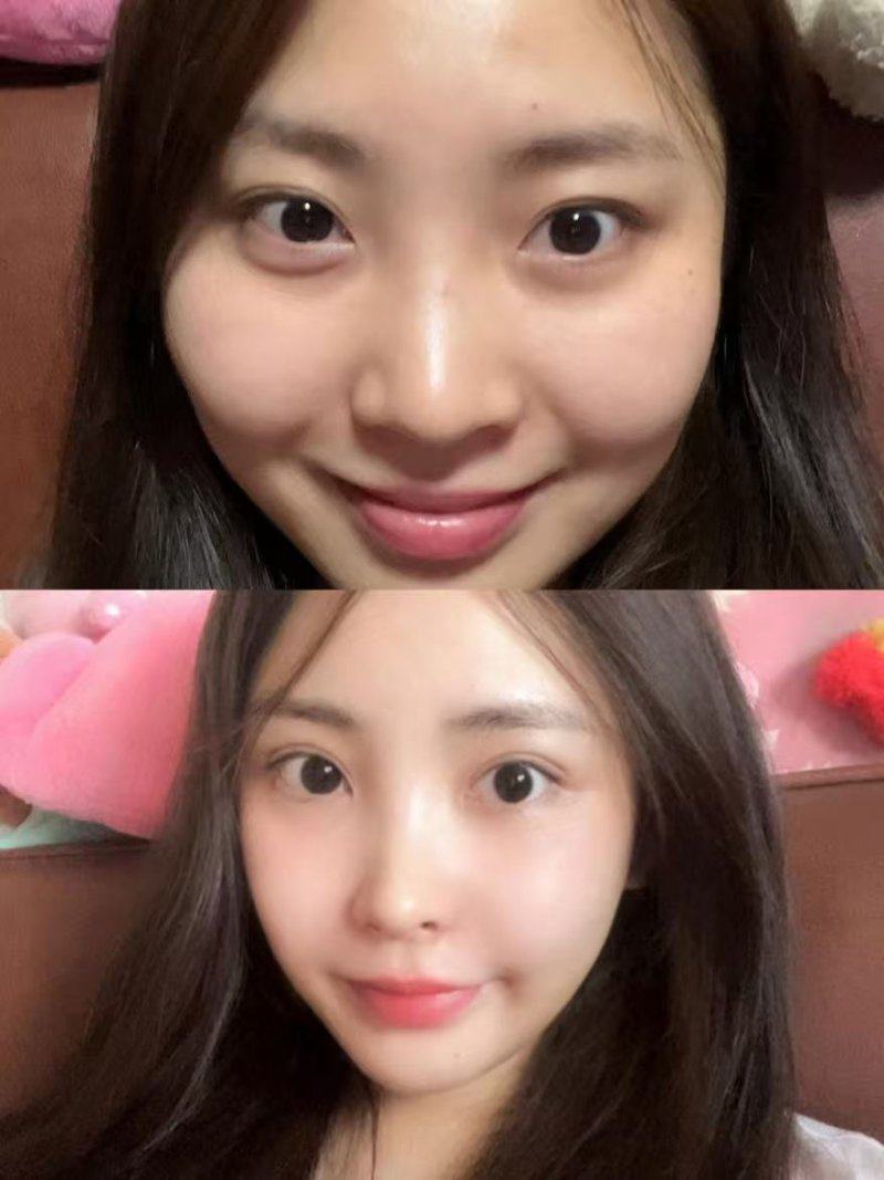 上饶市人民医院整形美容部口碑评价