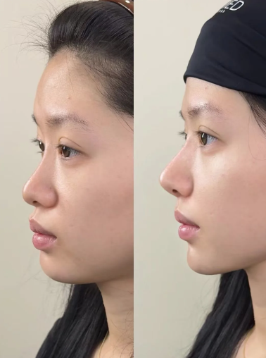 三、面部祛疤全新价格参考