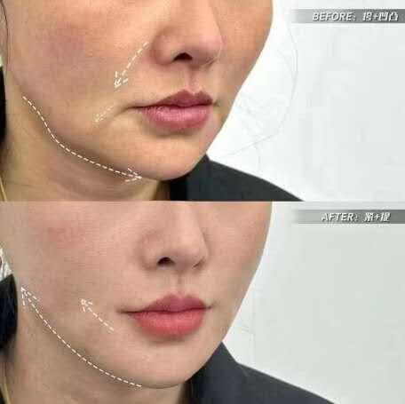 监利白衣天使医疗美容诊所口碑评价: