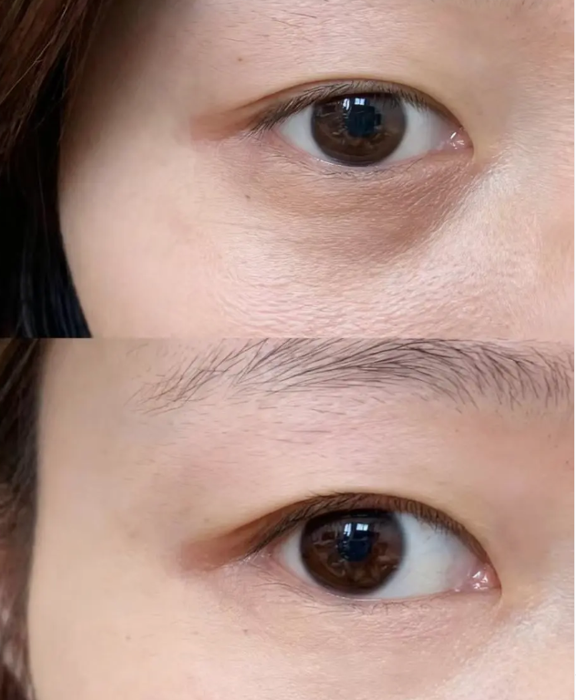 监利白衣天使医疗美容诊所擅长项目: