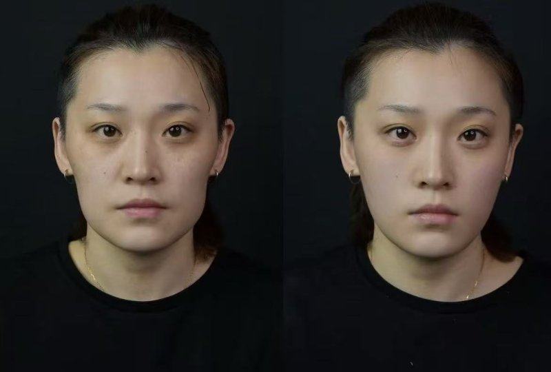 四、土豆片去眼袋一般敷多久?有哪些注意事项?