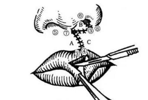 四、脸上有疤痕黑色素用什么可以淡化