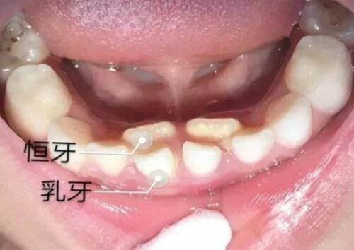 二、把握修复的黄金时机