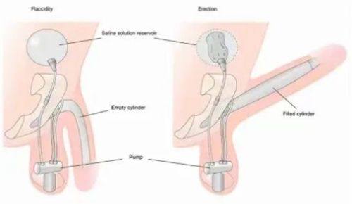 五、脸上有疤痕黑色素如何消除