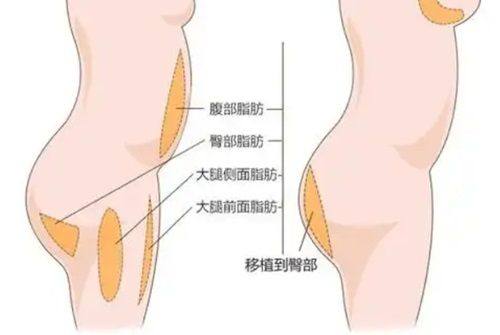 四、不同失败情况的修复方法