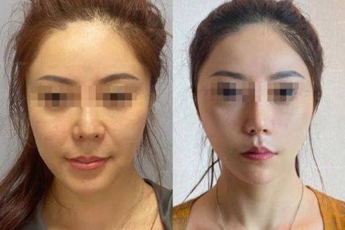 深圳天丽医疗美容医院口碑评价: