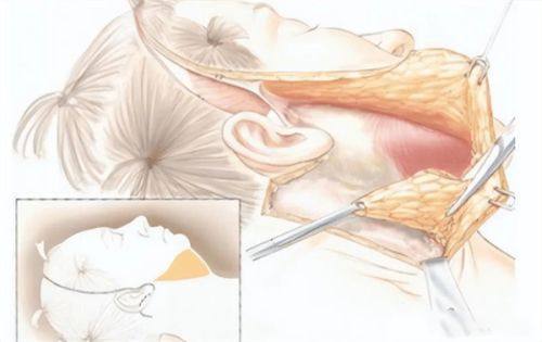 三、脸上留下的黑色疤痕可以用什么药